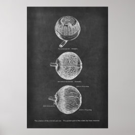 Anatomie des menschlichen Auges Arterien des Choro Poster