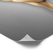 Anatomie des menschlichen Beckenknochens 2 Poster (Ecke)