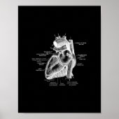 Anatomie des menschlichen Herzens in Schwarz und W Poster (Vorne)