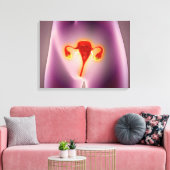 Anatomie des weiblichen Körpers mit Uterus Leinwanddruck (Insitu (Wohnzimmer))
