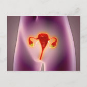 Anatomie des weiblichen Körpers mit Uterus Postkarte (Vorderseite)