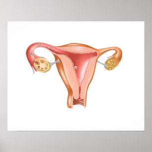 Anatomie des weiblichen Uterus 1 Poster