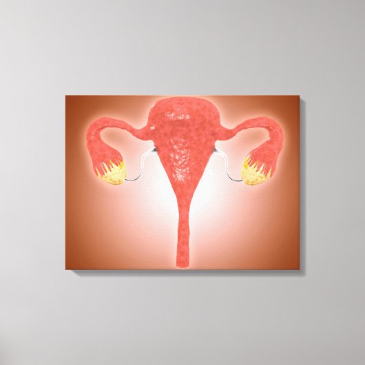 Anatomie des weiblichen Uterus mit Ovarien Leinwanddruck (Vorderseite)