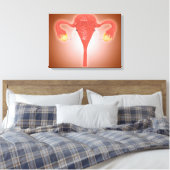 Anatomie des weiblichen Uterus mit Ovarien Leinwanddruck (Insitu (Schlafzimmer))
