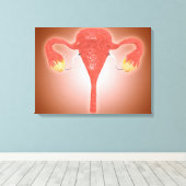 Anatomie des weiblichen Uterus mit Ovarien Leinwanddruck (Insitu (Holzboden))