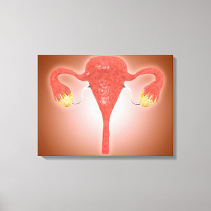 Anatomie des weiblichen Uterus mit Ovarien Leinwanddruck