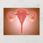 Anatomie des weiblichen Uterus mit Ovarien Postkarte (Vorderseite)