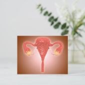 Anatomie des weiblichen Uterus mit Ovarien Postkarte (Stehend Vorderseite)