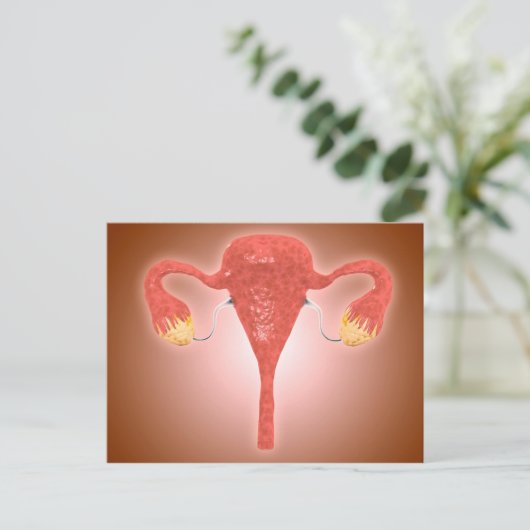 Anatomie des weiblichen Uterus mit Ovarien Postkarte (Stehend Vorderseite)