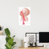 Anatomie einer Tracheesophagealfistula Poster (Heimbüro)