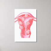 Anatomie fibroider Tumoren bei weiblichen Uterusze Leinwanddruck (Vorderseite)