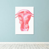 Anatomie fibroider Tumoren bei weiblichen Uterusze Leinwanddruck (Insitu (Holzboden))