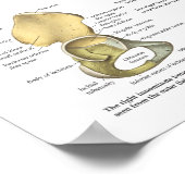 Anatomische Abbildung der Knochen angesagt und Pel Poster (Ecke)