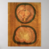 Anatomischer zeichn des menschlichen Gehirns Poster (Vorne)