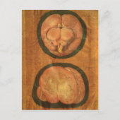 Anatomischer zeichn des menschlichen Gehirns Postkarte (Vorderseite)