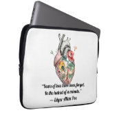 Anatomisches Herz Laptopschutzhülle (Vorne Rechts)