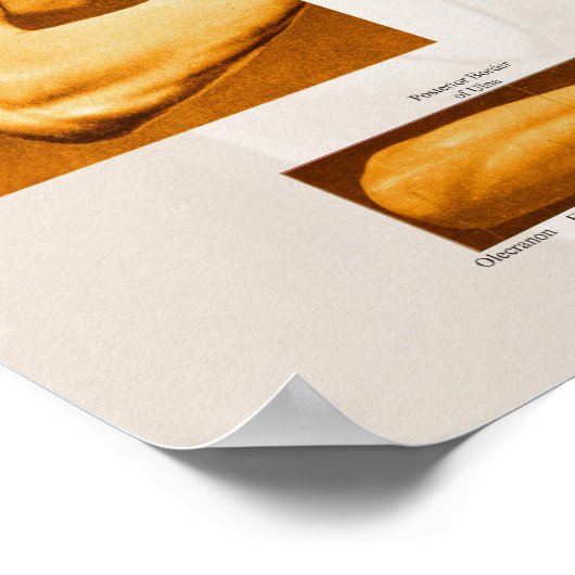 Anatomisches Poster Arm & Schulter (Ecke)