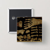 Anatomisches Zeichnen der Knochen des Fußes Button (Vorne & Hinten)