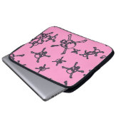 Ändern der Farbskulturen Laptopschutzhülle (Vorne Knopf)
