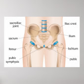 Angesagte Schmerzbursitis Poster (Vorne)