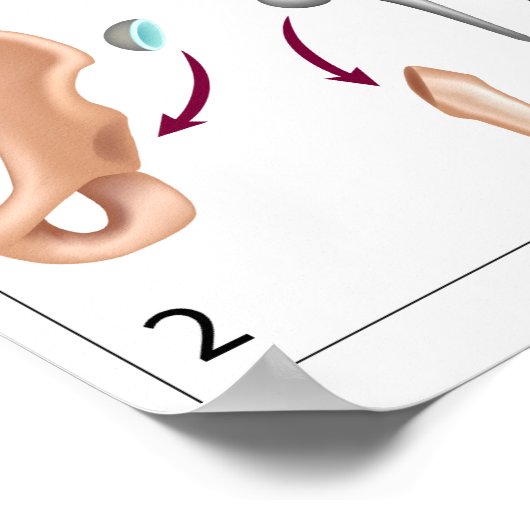 Angesagter Ersatzdruck für Operationen insgesamt Poster (Ecke)