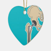 Angesagter gemeinsamer Ersatz Keramik Ornament (Links)