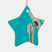 Angesagter gemeinsamer Ersatz Keramikornament (Rechts)