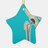 Angesagter gemeinsamer Ersatz Keramikornament (Links)