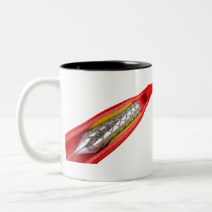 Angioplastik Zweifarbige Tasse