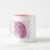 Angststörungen Zweifarbige Tasse (Vorderseite Links)