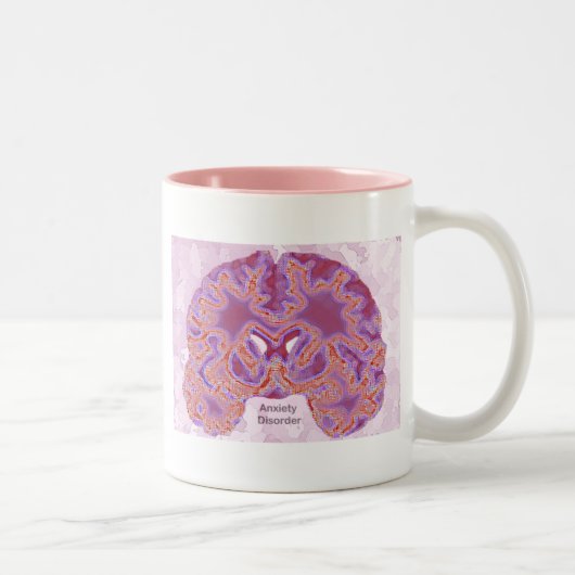 Angststörungen Zweifarbige Tasse (Rechts)