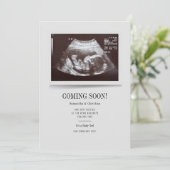 Ankündigung der Schwangerschaft im modernen Ultras (Stehend Vorderseite)