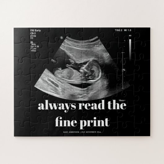 Ankündigung einer benutzerdefinierten UltraschallS Puzzle (Horizontal)