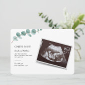 Ankündigung einer Schwangerschaft Baby Sonogram (Stehend Vorderseite)