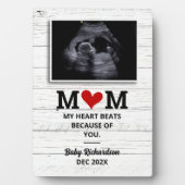 Ankündigung eines Tumors der Schwangerschaft Sonog Fotoplatte (Vorderseite)