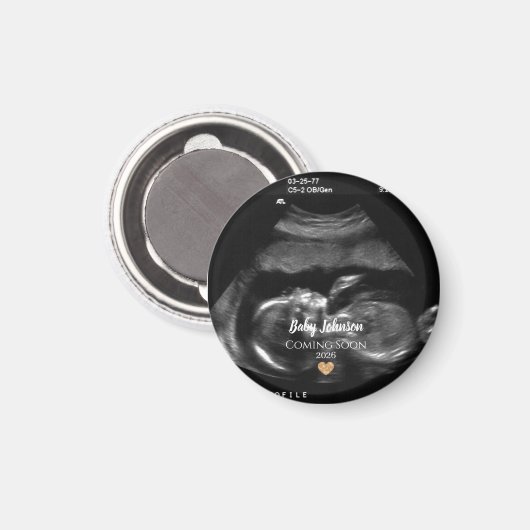 Ankündigung von Baby Comon Sonogram Magnet (Vorderseite/Rückseite)