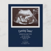 Ankündigung von Baby Ultrasound Foto Schwangerscha (Vorderseite)