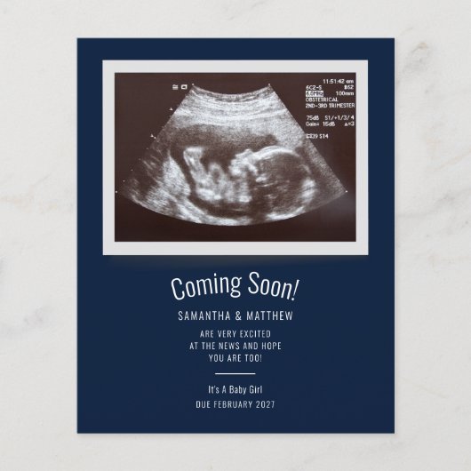 Ankündigung von Baby Ultrasound Foto Schwangerscha (Vorderseite)