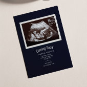 Ankündigung von Baby Ultrasound Foto Schwangerscha