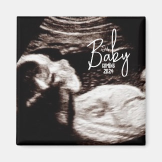 Ankündigung von "Black and White Baby Ultrasound B Magnet