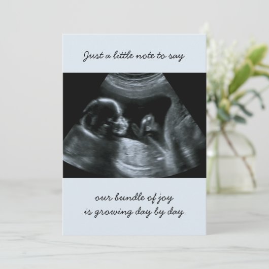 Ankündigung von Sonogram Foto Pale Blue Pregnancy (Stehend Vorderseite)