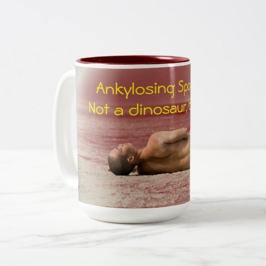 Ankylosing Spondylitis, nicht eine Zweifarbige Tasse (Vorderseite Links)