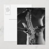 Ansicht der Rückenmarkskord Postkarte (Vorne/Hinten)