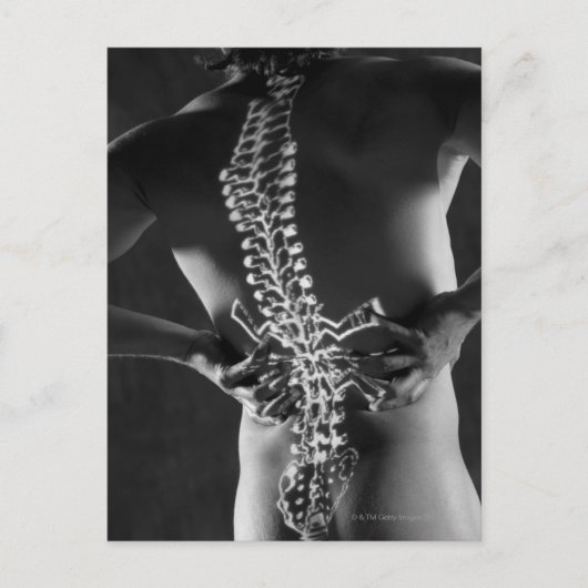 Ansicht der Rückenmarkskord Postkarte (Vorderseite)