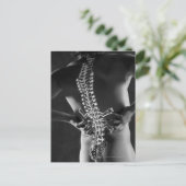 Ansicht der Rückenmarkskord Postkarte (Stehend Vorderseite)