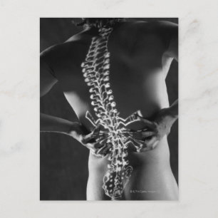 Ansicht der Rückenmarkskord Postkarte