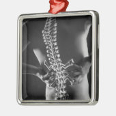 Ansicht des spinalen Akkords Silbernes Ornament (Links)