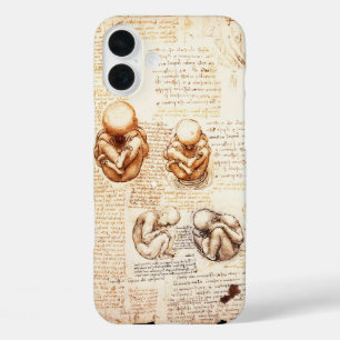 Ansichten eines Fetus in der Frau, Ob-Gyn Medical iPhone 16 Plus Hülle