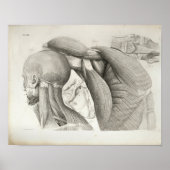 Antique Neck Schultermuskeln Medizinische Printwer Poster (Vorne)