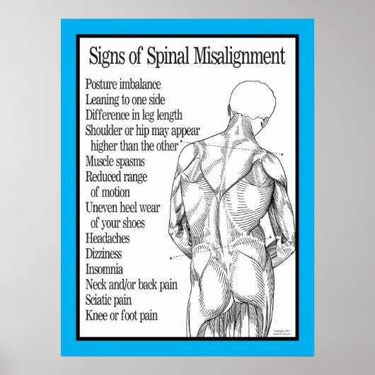 Anzeichen einer Rückenmarksverstimmung Chiroprakti Poster (Vorne)